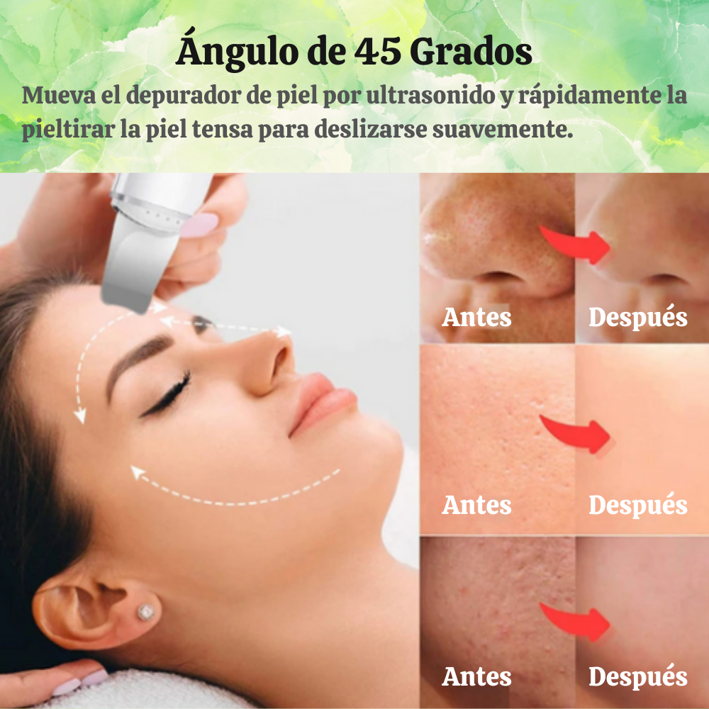 SkinWave Pro™ - Exfoliador Ultrasónico